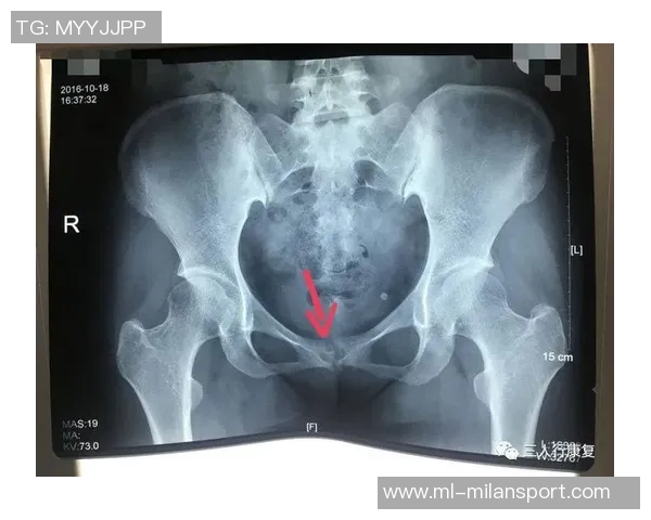 尼科威廉姆斯谈耻骨炎恢复过程并表示需带伤出战的挑战与决心